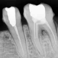 Dental Imaging