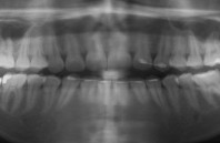 Plastic Oral Exam Imaging