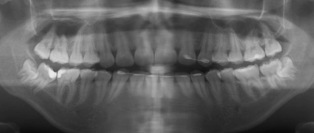 Plastic Oral Exam Imaging